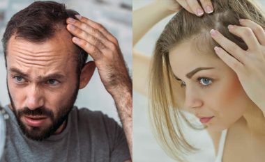 A keni probleme me rënie të flokëve? – Atëherë duheni me provu këtë shampon që s’kushton as 14 euro