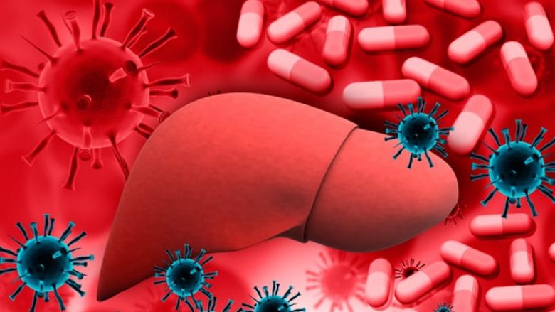 Çfarë e shkakton hepatitin dhe cilat janë simptomat kryesore që duhen pasur parasysh?