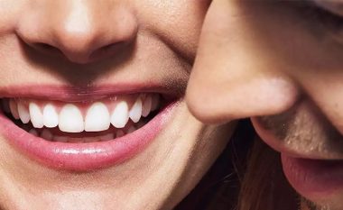 Çfarë u bën puthja dhëmbëve tanë? Dentisti zbulon sekretin