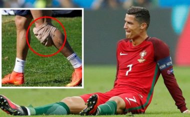 Ronaldo u diagnostikua me një lëndim që nuk ka 'shërim' dhe përkeqësohet me kalimin e kohës