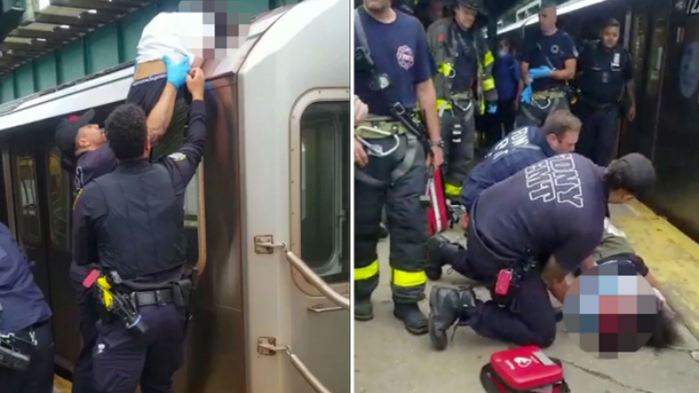 Trendi i vrapimit në çatitë e trenave në New York – djaloshi 15-vjeçar goditi kokën në një objekt dhe është në gjendje kritike