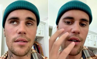 A ka lidhje paraliza e fytyrës së Justin Bieber me vaksinën anti-COVID?