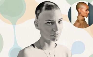 Trajtimi i parë sistematik për alopecia areata është miratuar nga FDA