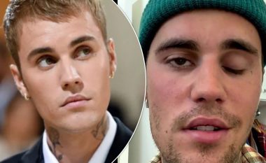 Eksperti neurologjik Derick Wade  thotë se paraliza e fytyrës së Justin Bieber mund t’i shkaktojë dëme afatgjata