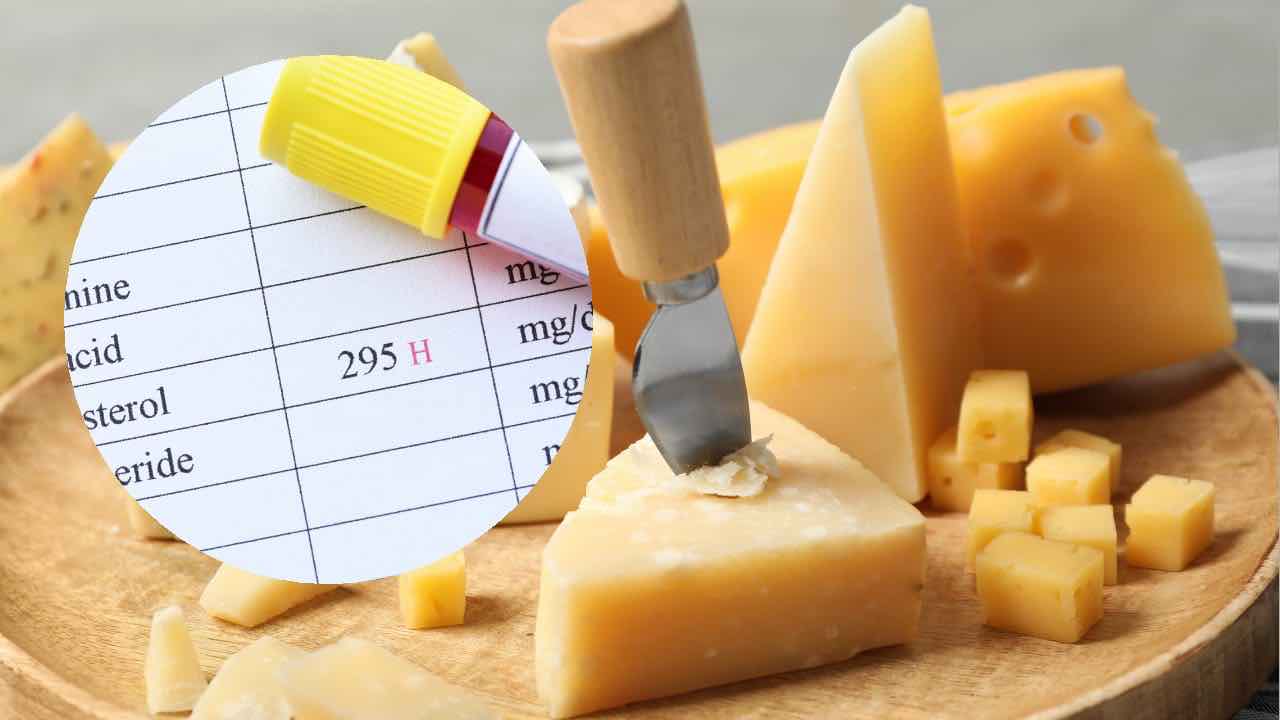 Nëse keni kolesterinë të lartë, mos hiqni dorë nga djathi: Vetëm një lloj është i dëmshëm!