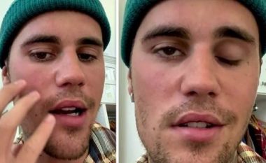 Justin Bieber zbulon se po vuan nga paraliza e fytyrës pasi u diagnostikua me sindromën Ramsay Hunt