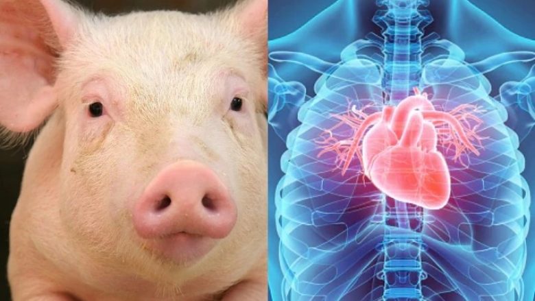Në SHBA kryhet transplantimi i dy zemrave të derrit të modifikuara gjenetikisht