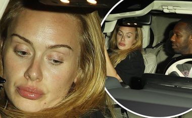 Adele shihet me buzë jashtëzakonisht më të fryra se zakonisht
