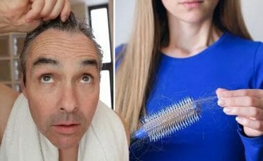 Shkencëtarët zbulojnë shkaktarin gjenetik që mund të kurojë rënien e flokëve, thotë studimi i ri