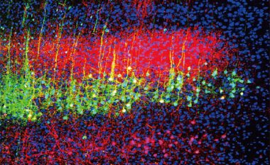 Shkencëtarët identifikojnë mekanizmat nervorë përmes të cilëve tingulli shkakton analgjezi te minjtë