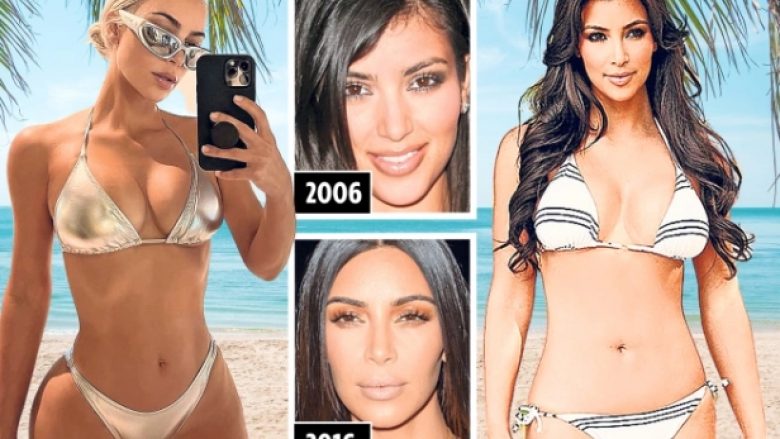 Kim Kardashian pretendon se nuk ka kryer kurrë operacione plastike, por doktori i famshëm britanik ngre dyshimet