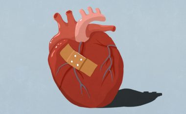 Çfarë është sindroma e zemrës së thyer dhe si ndryshojnë simptomat nga sulmi në zemër?