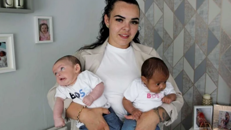 Gruaja lindi binjakët që kanë ngjyrë të ndryshme