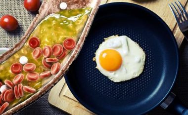 A mund të konsumoni vezë nëse keni kolesterol të lartë?