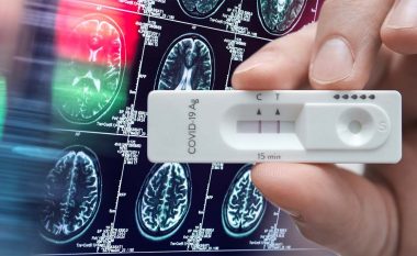 COVID-19 mund të rrisë rrezikun e rënies së pakthyeshme të trurit me 80 për qind “brenda një viti”, paralajmëron studimi i ri