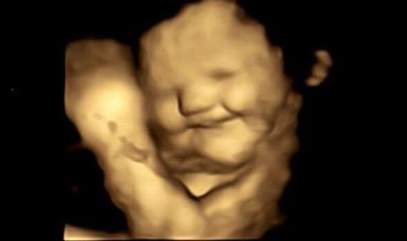 Eating carrots during pregnancy makes babies happy and green cabbage