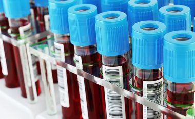 Testi i gjakut që mund të zbulojë 50 lloje kanceri shfaqet ‘premtues’ në provat e hershme