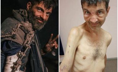 Imazhe tronditëse të luftëtarit të Azovstal pasi u lirua së fundmi nga forcat ruse