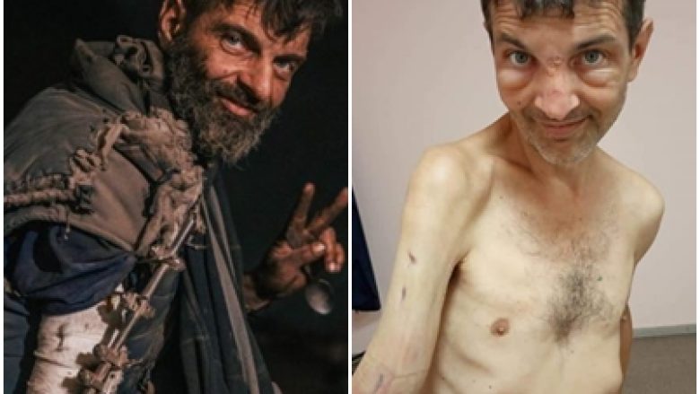 Imazhe tronditëse të luftëtarit të Azovstal pasi u lirua së fundmi nga forcat ruse