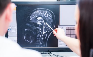 Një imazh i papritur i një truri që po vdiste u zbuloi shkencëtarëve atë që pacienti “pa” mu para vdekjes së tij