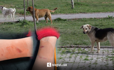 Katërvjeçari kafshohet nga një qen endacak në oborrin e çerdhes publike në Prishtinë – nëna e tij tregon ngjarjen