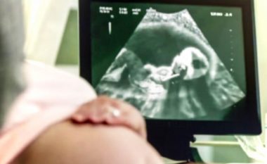 Bebja rreth javës së 28-të hap sytë në bark: Xhirimi magjepsës me ultrazë