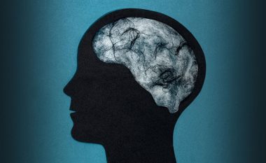 Mjegulla e trurit – karakteristikat kryesore