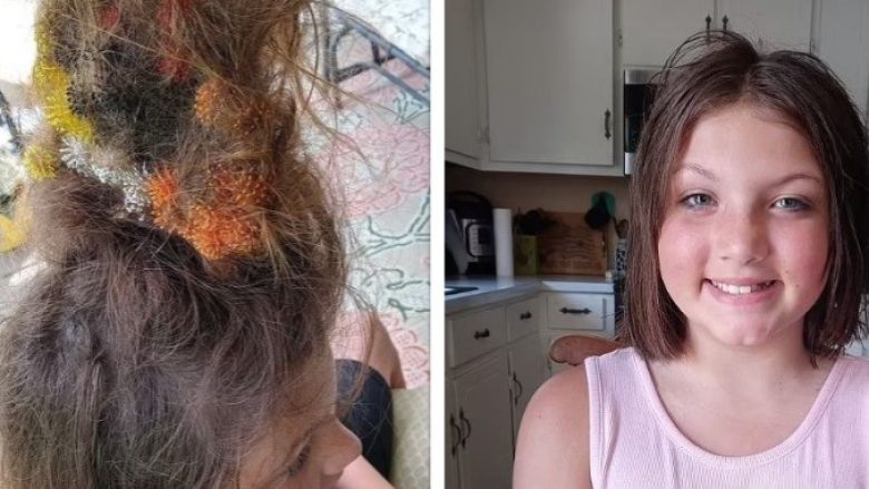 11-vjeçarja në SHBA u detyrua t’i priste flokët pasi iu ngjitën lodrat në to