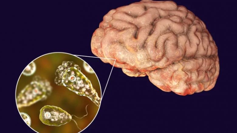 Koreja e Jugut raporton rastin e parë të infeksionit të “amebës që ha trurin” – infeksionit të rrallë, por shumë vdekjeprurës