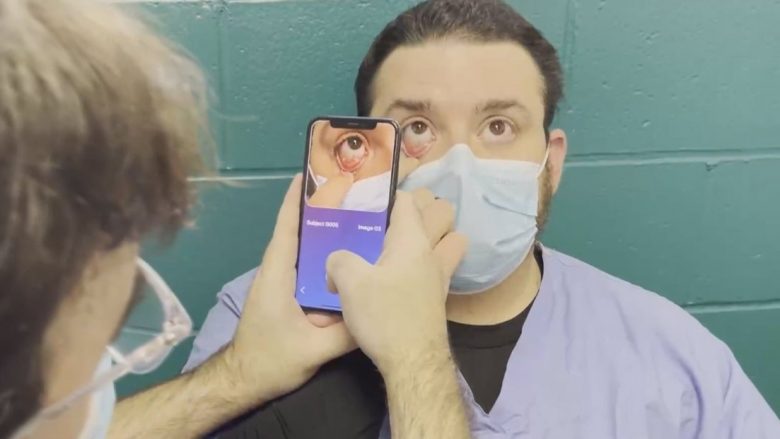 Mjeku turk shpik aplikacionin, thuhet se zbulon aneminë “sa hap e mbyll sytë”