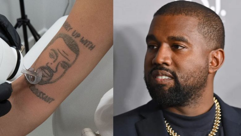 Për fansat e penduar, një studio në Londër po ofron heqjen e tatuazheve të Kanye West falas