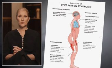 Shpjegimi i neurologëve për sindromën e personit të ngurtë
