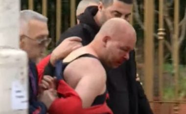 Goditi me grusht Berishën, sulmuesi i gjakosur arrestohet nga policia