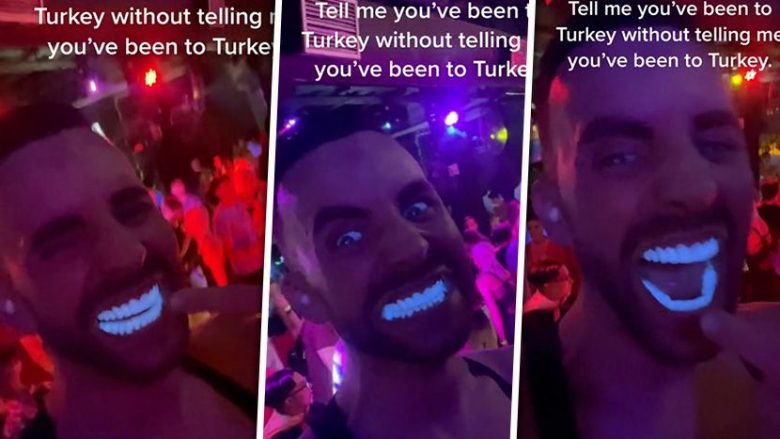 Rregulloi dhëmbët në Turqi, por nuk e kuptoi pse të gjithë po e shikonin: Buzëqeshja e të riut u bë hit në rrjetet sociale