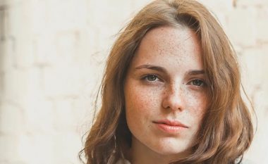 Piklat në fytyrë janë më të zakonshme te vajzat me lëkurë të shndritshme dhe flokë të kuq