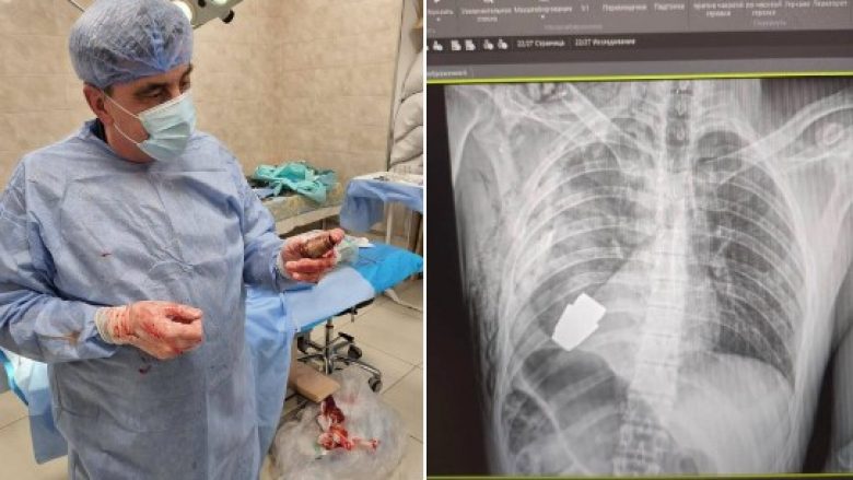 Ishte shumë afër zemrës së tij – detaje rreth rastit në të cilin kirurgët hoqën granatën e pashpërthyer nga gjoksi i ushtarit ukrainas