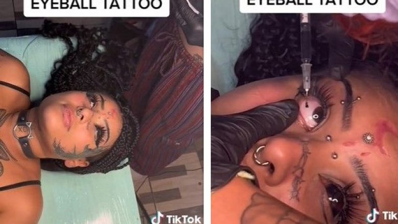 Braziliania bën tatuazh të bardhën e syve – publikon procesin në TikTok derisa i injektohet boja e zezë me shiringë