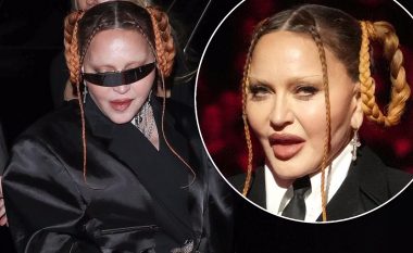 Madonna më në fund pranon se ka bërë operacione plastike në fytyrë, pasi habiti fansat me ndryshimin gjatë “Grammy Awards”