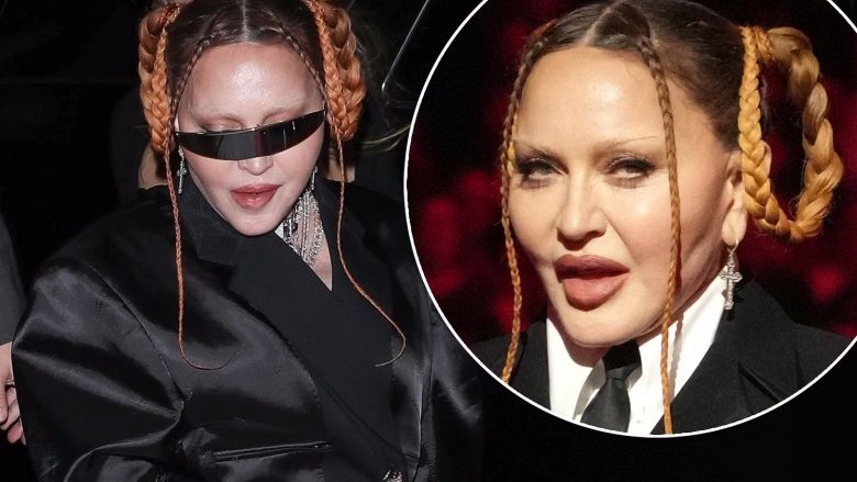 Madonna më në fund pranon se ka bërë operacione plastike në fytyrë, pasi habiti fansat me ndryshimin gjatë “Grammy Awards”