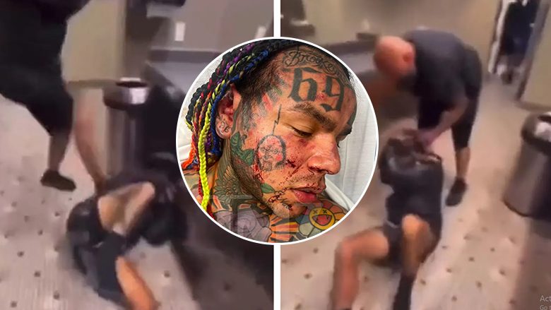 Reperin Tekashi 6ix9ine e rrahin brutalisht në një palestër, më pas dërgohet me urgjencë në spital