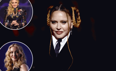 Madonna e dëshpëruar për ta rikthyer pamjen natyrale të fytyrës para turneut botëror