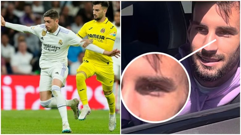 Alex Baena shihet me shenjë në sy pesë ditë pasi u sulmua nga Fede Valverde