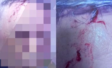 Arrestohet shtetasi serb në Jarinjë, sulmoi policin e Kosovës dhe i shkaktoi plagë në kokë