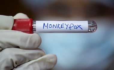 OBSH shpalli fundin e epidemisë së lisë së majmunit