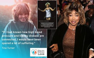 Si i ‘parapriu’ vdekjes së parakohshme Tina Turner me publikimin e një postimi ogurzi në Instagram vetëm dy muaj më parë