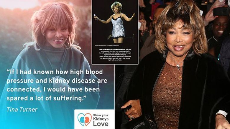 Si i ‘parapriu’ vdekjes së parakohshme Tina Turner me publikimin e një postimi ogurzi në Instagram vetëm dy muaj më parë