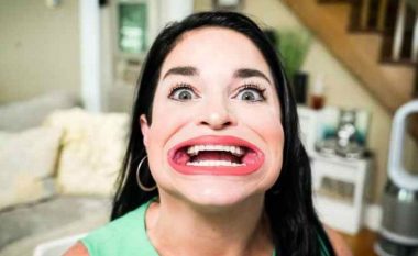Gruaja me gojën më të madhe në botë tregon për komentet që merr nga njerëzit