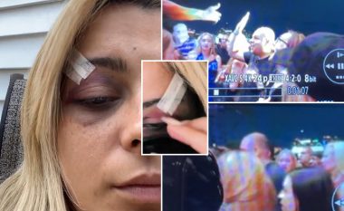 Publikohen të tjera pamje nga arrestimi i sulmuesit dhe gjendja e Bebe Rexhës pas lëndimit në koncertin famëkeq