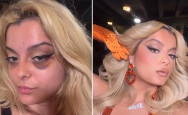 Para dhe pas makijazhit: Bebe Rexha tregon se si po arrin ta kamuflojë syrin e nxirë për koncertet e radhës