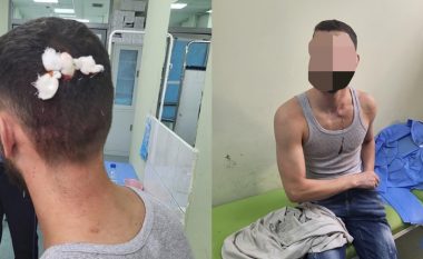 Policia thotë se sulmi ndaj dy shqiptarëve në veri u krye nga një grup kriminelësh – të njëjtit pranuan tretman mjekësor